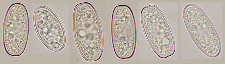 Sarcoscypha austriaca